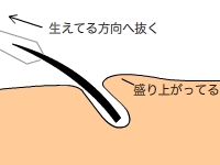 毛穴と方向